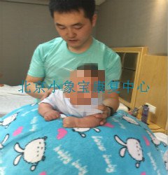 康复科bobath球在康复中的