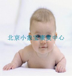 智力残疾的康复训练续篇