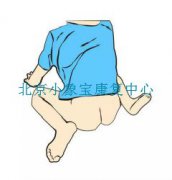 小儿脑瘫的行为