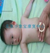小儿推拿的基本病理特点