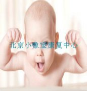 治疗发育迟缓的方案